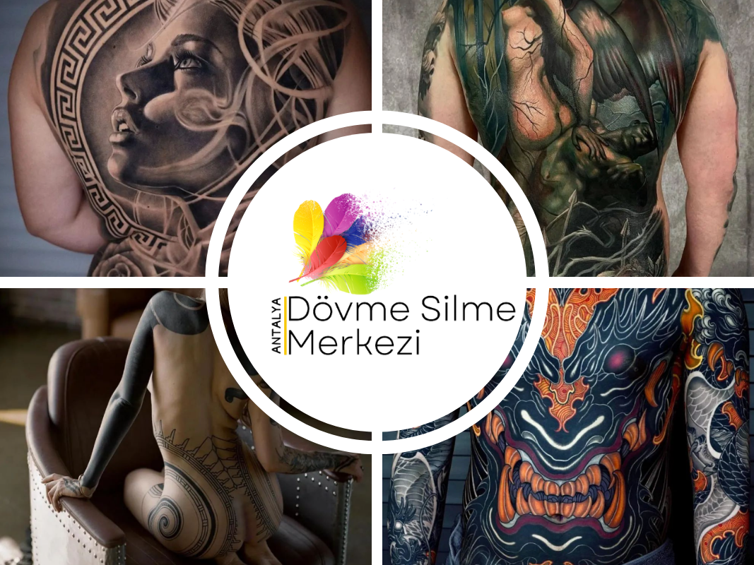 Antalya Dövme Silme