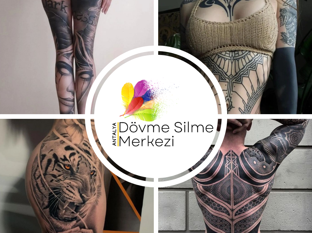 Is Tattoo Removal Painful? Experiences and Opinions