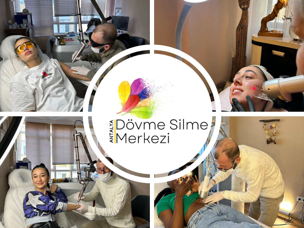 Antalya Dövme Silme