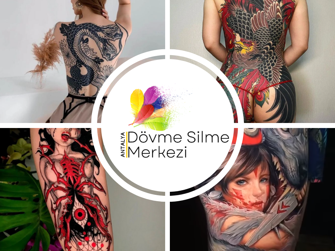 Antalya Dövme Silme