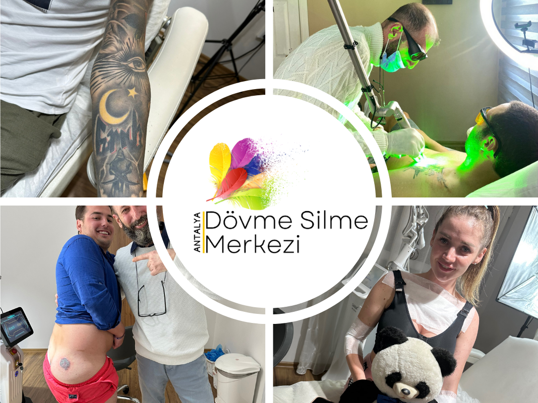 Больно ли удалять татуировку? Отзывы и реальные ощущения