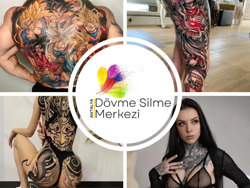 Antalya Dövme Silme